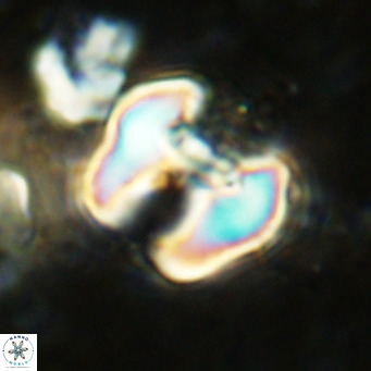 Perchnielsenella ismailkoselii VR 11402
