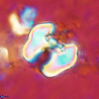 Perchnielsenella ismailkoselii VR 11403