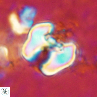 Perchnielsenella ismailkoselii VR 11403