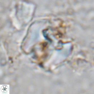 Perchnielsenella ismailkoselii VR 11404
