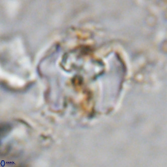 Perchnielsenella ismailkoselii VR 11405