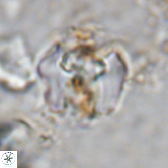Perchnielsenella ismailkoselii VR 11405