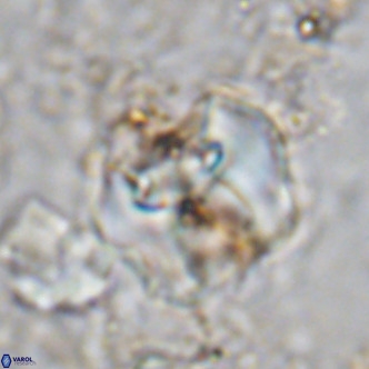 Perchnielsenella ismailkoselii VR 11406