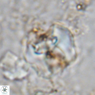 Perchnielsenella ismailkoselii VR 11406