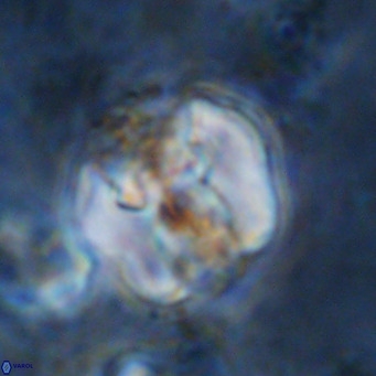Perchnielsenella ismailkoselii VR 11407