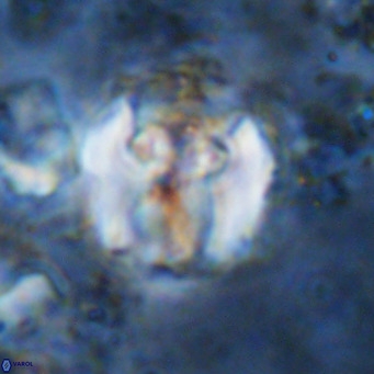 Perchnielsenella ismailkoselii VR 11408