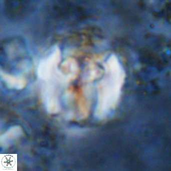 Perchnielsenella ismailkoselii VR 11408