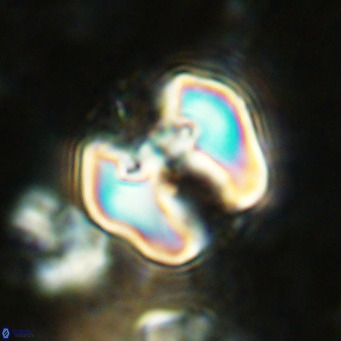 Perchnielsenella ismailkoselii VR 11399