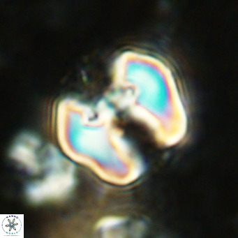 Perchnielsenella ismailkoselii VR 11399