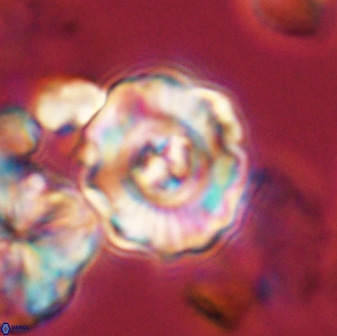 Perchnielsenella stradneri 41422
