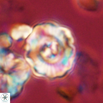 Perchnielsenella stradneri 41422