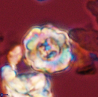 Perchnielsenella stradneri 41424