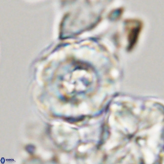 Perchnielsenella stradneri 41427