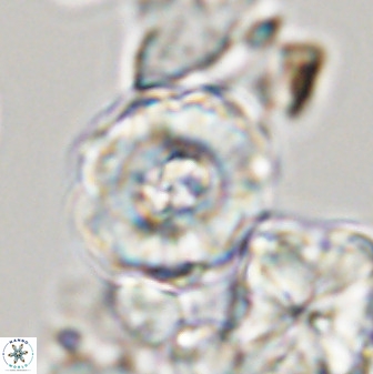 Perchnielsenella stradneri 41427