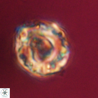 Perchnielsenella stradneri VR 22443