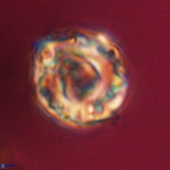 Perchnielsenella stradneri VR 22444