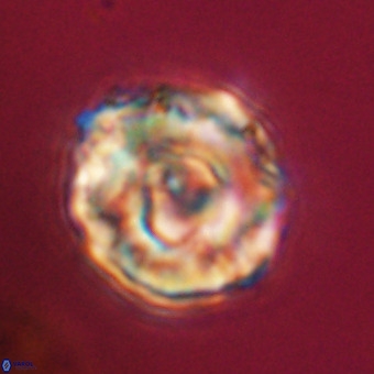 Perchnielsenella stradneri VR 22447