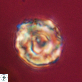 Perchnielsenella stradneri VR 22447