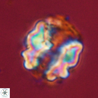 Perchnielsenella stradneri VR 22451