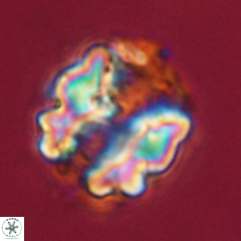 Perchnielsenella stradneri VR 22456