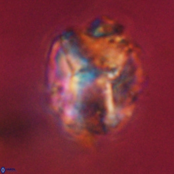 Perchnielsenella stradneri VR 22434