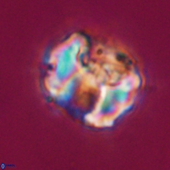 Perchnielsenella stradneri VR 22541
