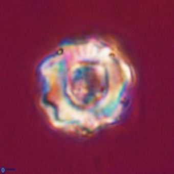 Perchnielsenella stradneri VR 22547