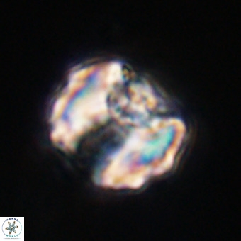 Perchnielsenella stradneri VR 22560
