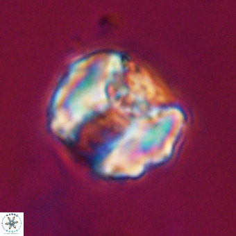 Perchnielsenella stradneri VR 22561