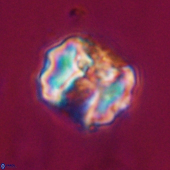 Perchnielsenella stradneri VR 22562
