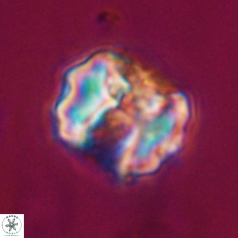 Perchnielsenella stradneri VR 22562