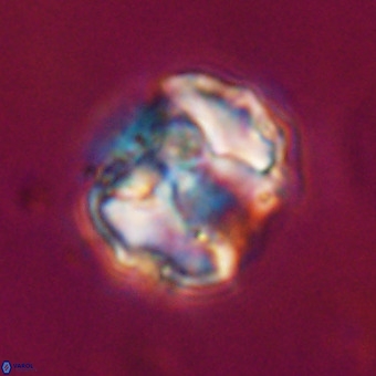 Perchnielsenella stradneri VR 22565