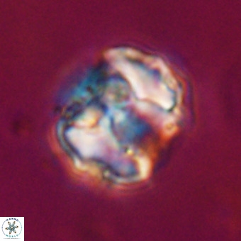 Perchnielsenella stradneri VR 22565