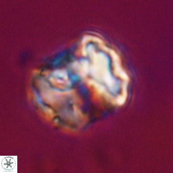 Perchnielsenella stradneri VR 22570