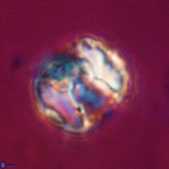 Perchnielsenella stradneri VR 22573