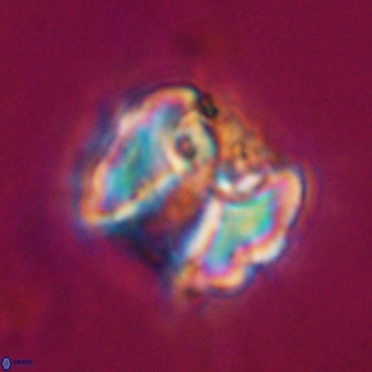 Perchnielsenella stradneri VR 22574