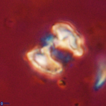 Perchnielsenella stradneri VR 22583
