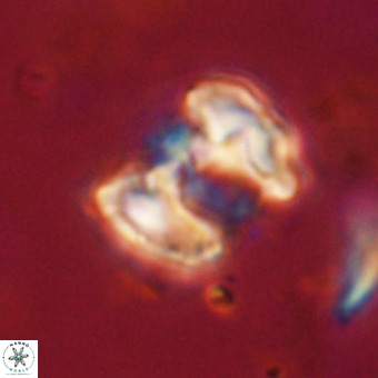Perchnielsenella stradneri VR 22583