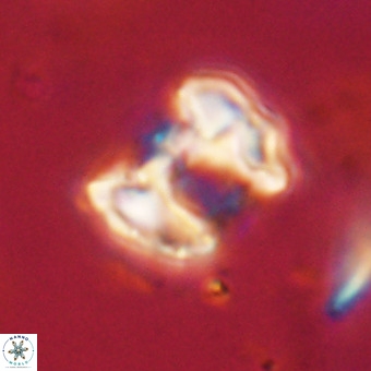 Perchnielsenella stradneri VR 22584