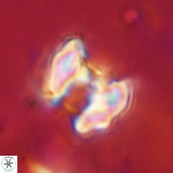 Perchnielsenella stradneri VR 22585