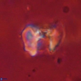 Perchnielsenella stradneri VR 22591