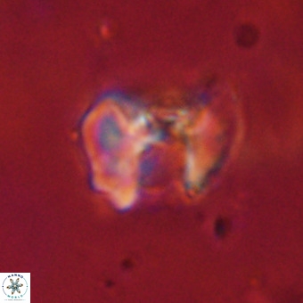 Perchnielsenella stradneri VR 22591