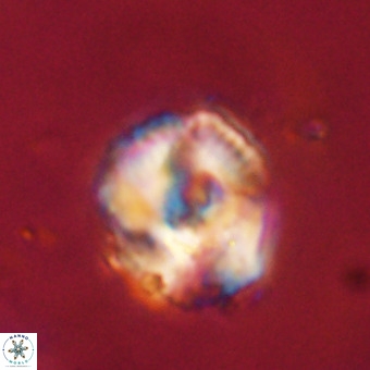Perchnielsenella stradneri VR 22594