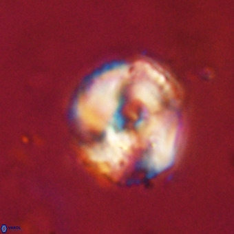 Perchnielsenella stradneri VR 22595