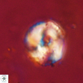 Perchnielsenella stradneri VR 22595
