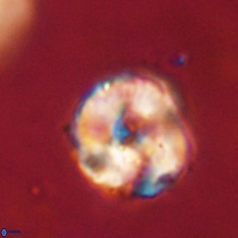 Perchnielsenella stradneri VR 22597