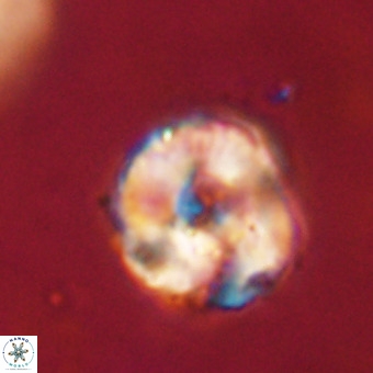 Perchnielsenella stradneri VR 22597
