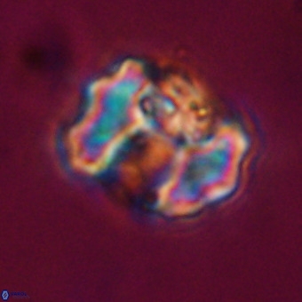 Perchnielsenella stradneri VR 22521