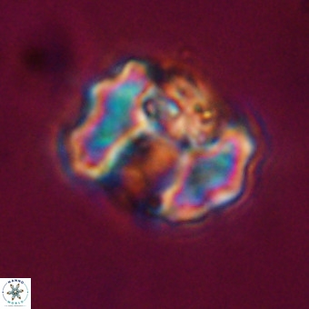 Perchnielsenella stradneri VR 22521