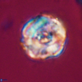 Perchnielsenella stradneri VR 22527